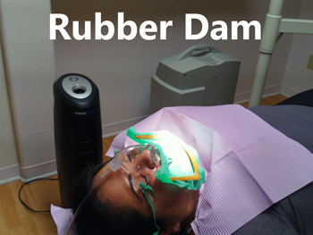 holistic dental rubber dam